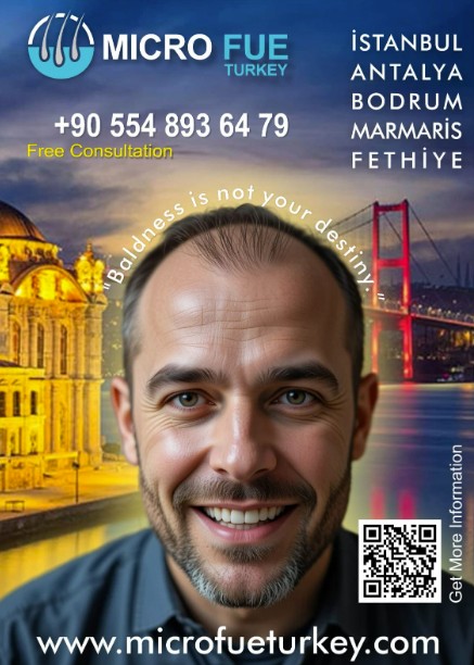 Hair transplant in Turkey Hair transplant in Turkey