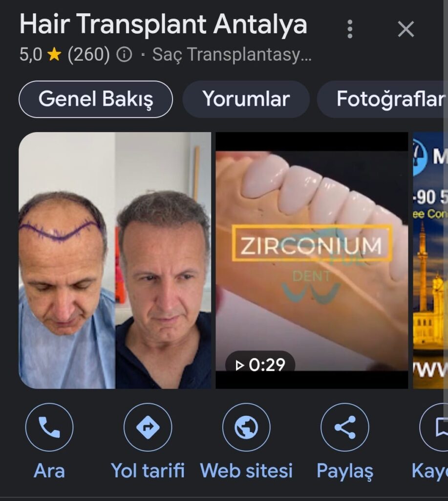 Hair Transplant Antalya